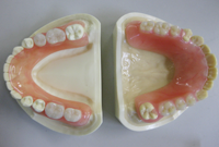 一般的な入れ歯（プラスチック床）※保険治療